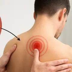 Illustration d'un muscle montrant un trigger point, avec une flèche pointant vers une zone douloureuse sur l'épaule d'un homme.