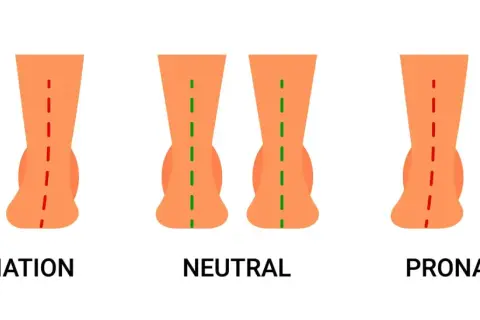 Comparaison des pieds : supination, neutre et pronation. La pronation est le mouvement naturel du pied vers l'intérieur lors de la marche.