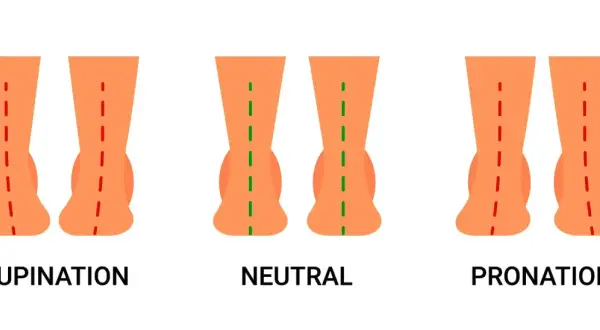Comparaison des pieds : supination, neutre et pronation. La pronation est le mouvement naturel du pied vers l'intérieur lors de la marche.