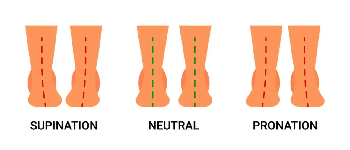Comparaison des pieds : supination, neutre et pronation. La pronation est le mouvement naturel du pied vers l'intérieur lors de la marche.