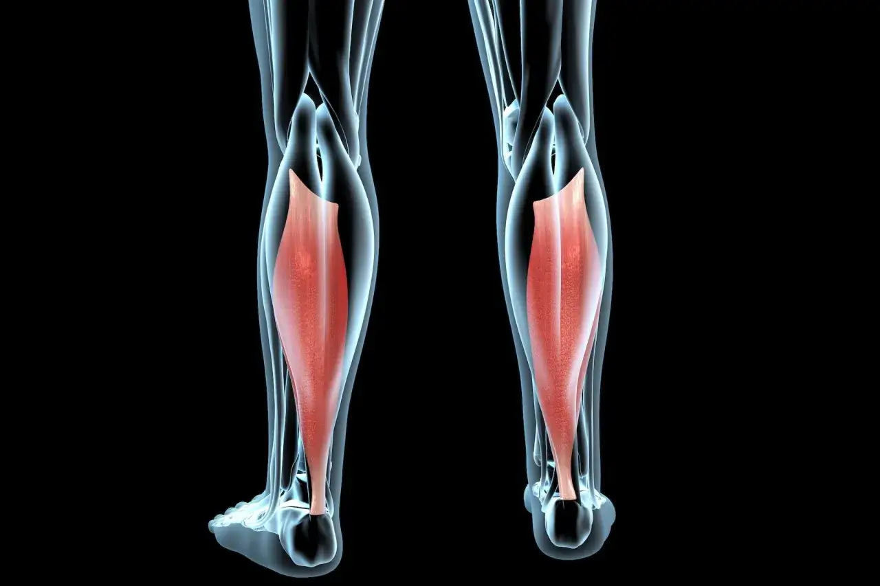 Vue anatomique des mollets, mettant en &eacute;vidence les muscles rouges. Une douleur vive peut signaler un claquage musculaire.