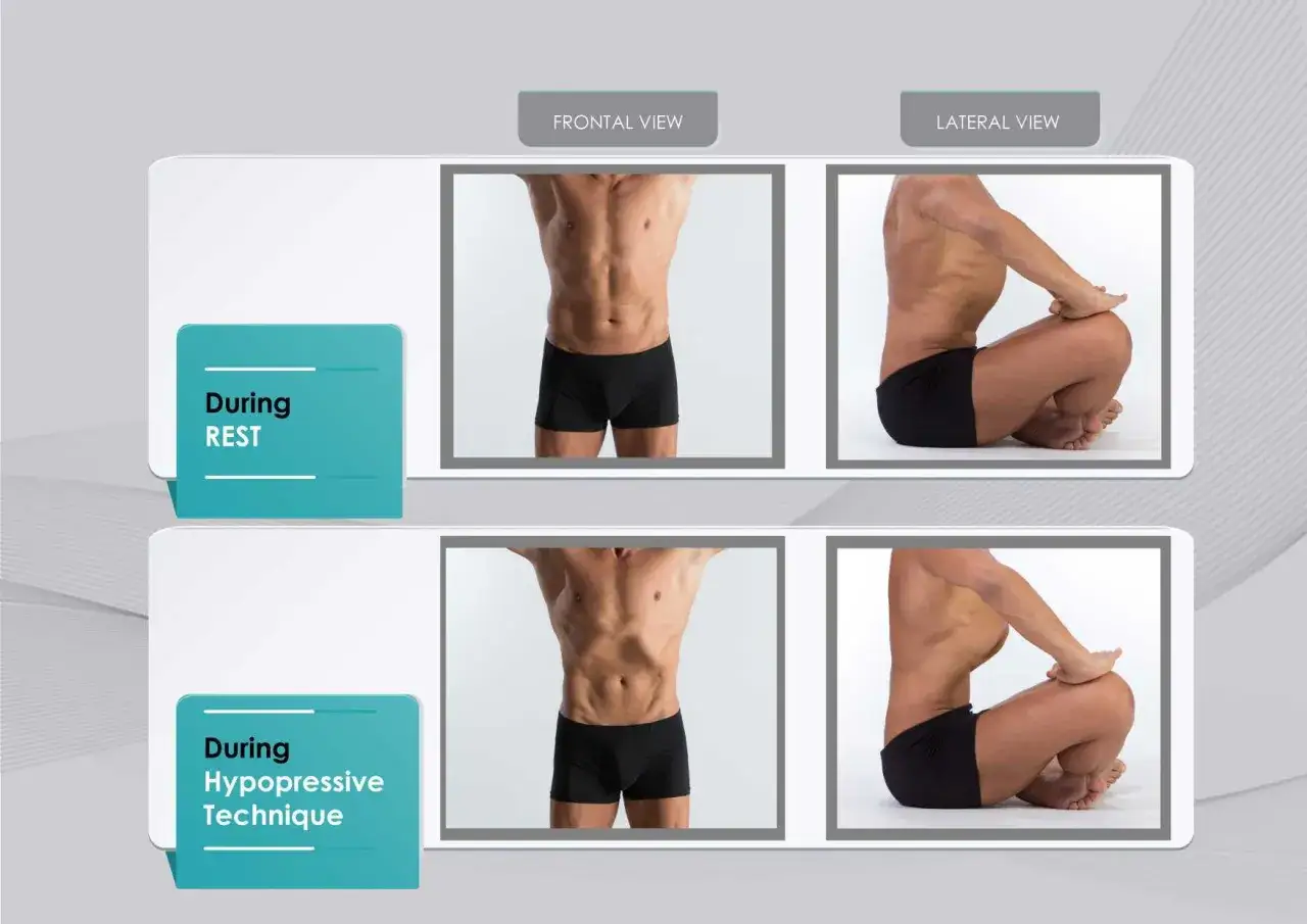 Comparaison des abdos : au repos, le ventre est détendu. Pendant la technique hypopressive, le ventre se creuse visiblement.