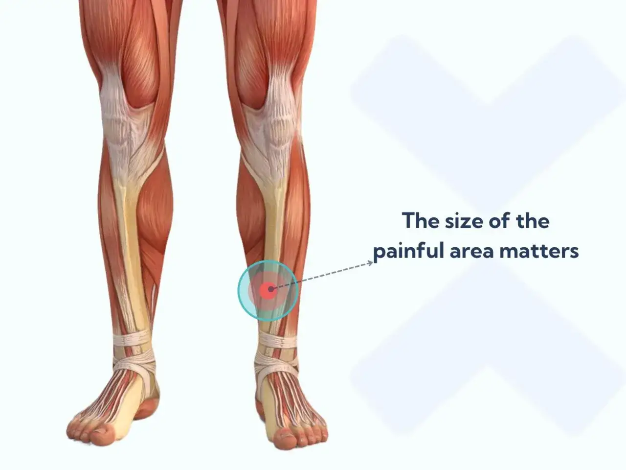Anatomie de la jambe montrant la douleur au tibia. Une zone rouge indique l'emplacement de la douleur.