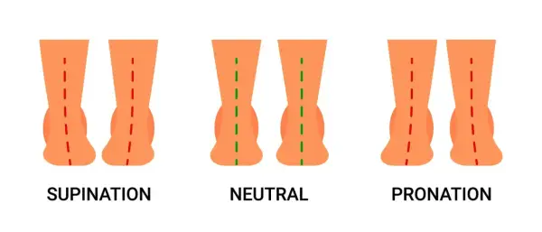 Comparaison des pieds : supination, neutre et pronation. La pronation est le mouvement naturel du pied vers l'intérieur lors de la marche.